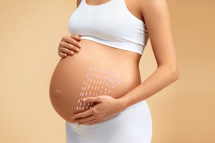 estriaS gravidez saúde nutrição beleza pele